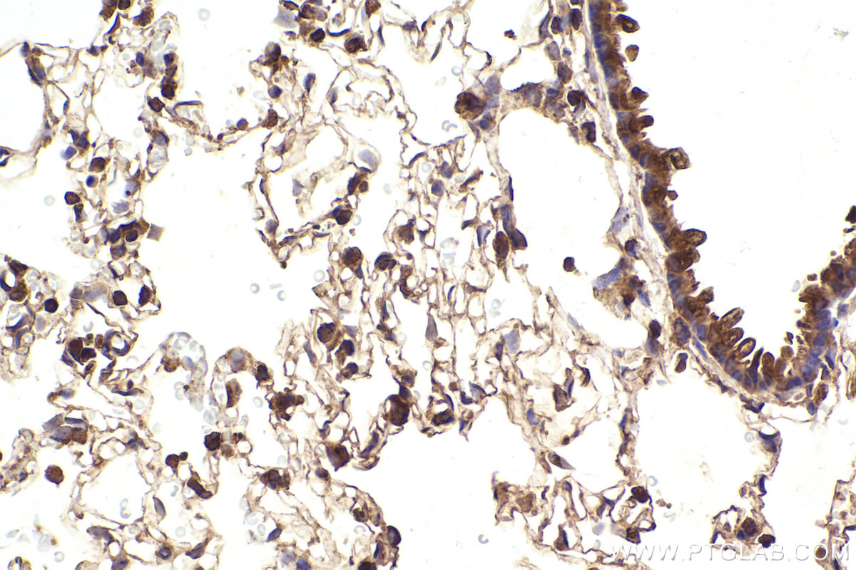 Immunohistochemical analysis of paraffin-embedded rat lung tissue slide using KHC2322 (IST1 IHC Kit).