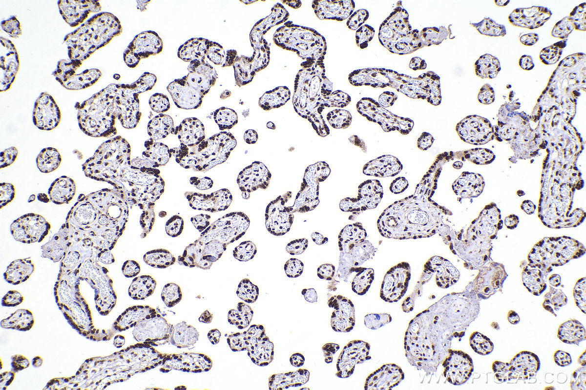 Immunohistochemical analysis of paraffin-embedded human placenta tissue slide using KHC2196 (JUND IHC Kit).