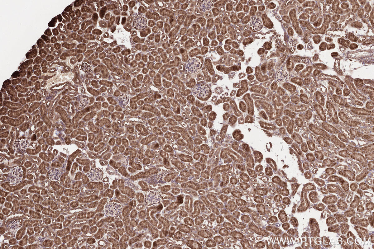 Immunohistochemical analysis of paraffin-embedded mouse kidney tissue slide using KHC2569 (KANK2 IHC Kit).