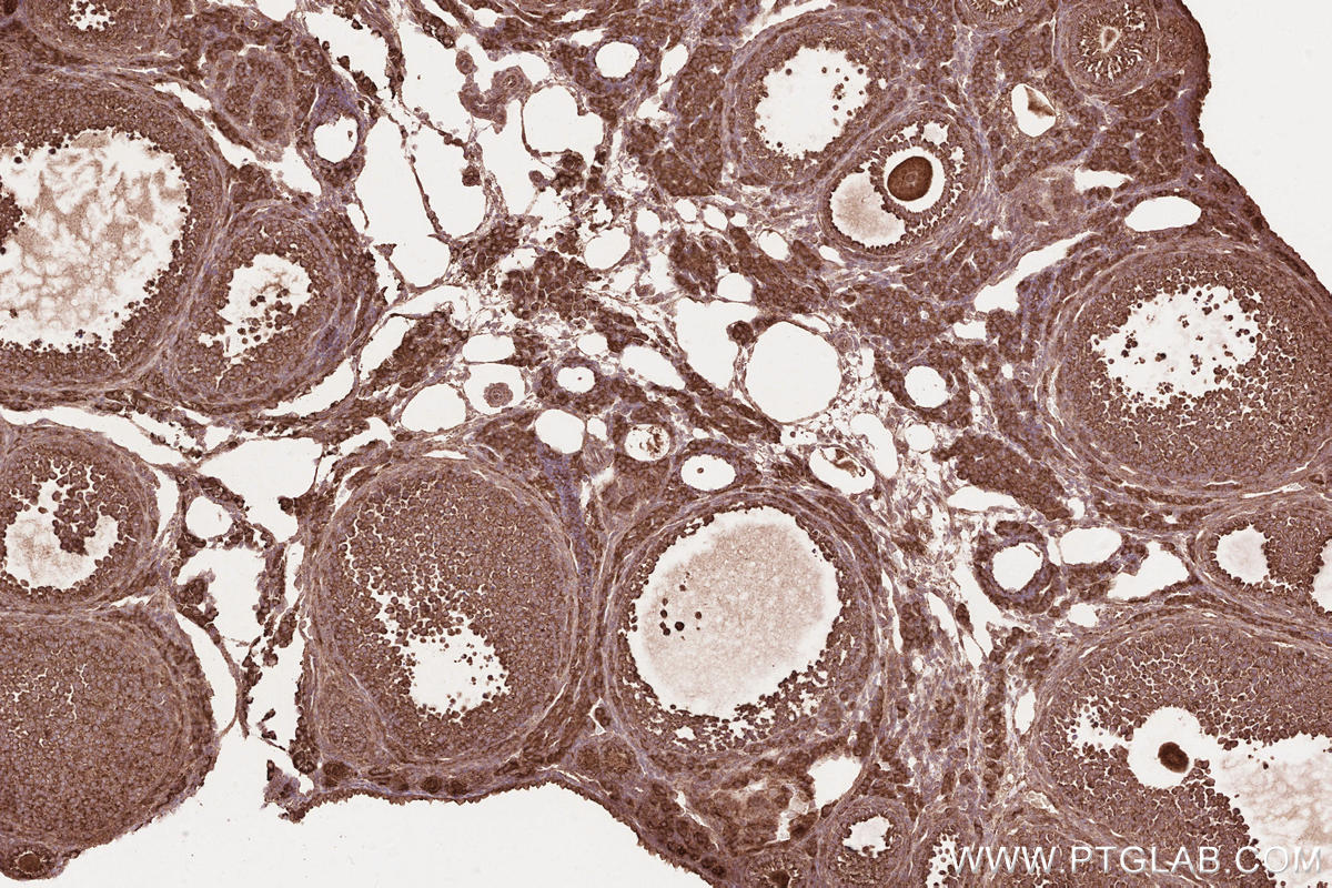 Immunohistochemical analysis of paraffin-embedded mouse ovary tissue slide using KHC2569 (KANK2 IHC Kit).