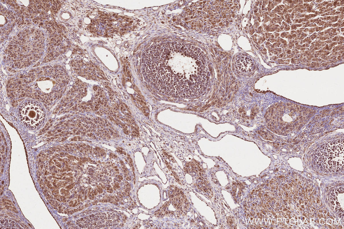 Immunohistochemical analysis of paraffin-embedded rat ovary tissue slide using KHC2569 (KANK2 IHC Kit).