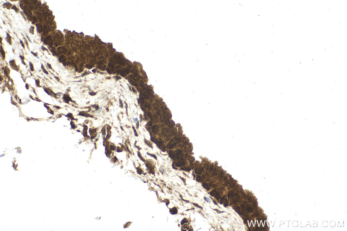 Immunohistochemical analysis of paraffin-embedded mouse bladder tissue slide using KHC2137 (KIF20A IHC Kit).