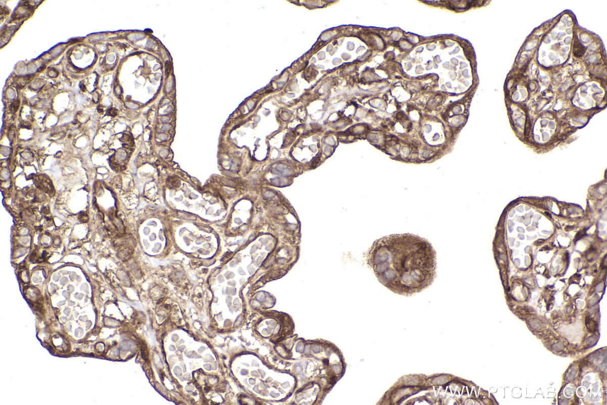 Immunohistochemical analysis of paraffin-embedded human placenta tissue slide using KHC2238 (KIF5B IHC Kit).