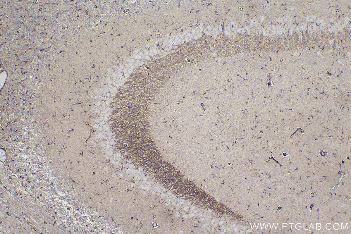 Immunohistochemical analysis of paraffin-embedded rat brain tissue slide using KHC2238 (KIF5B IHC Kit).