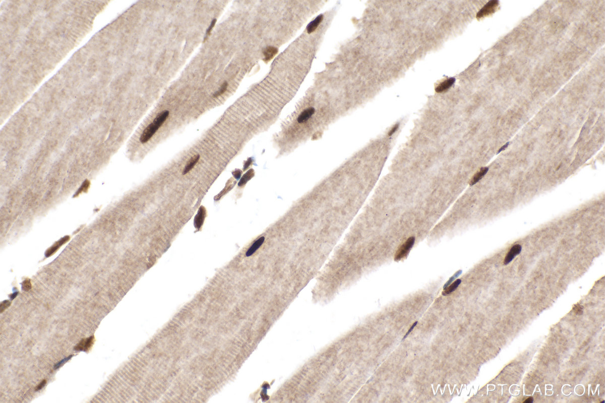 Immunohistochemical analysis of paraffin-embedded mouse skeletal muscle tissue slide using KHC2104 (KIN IHC Kit).