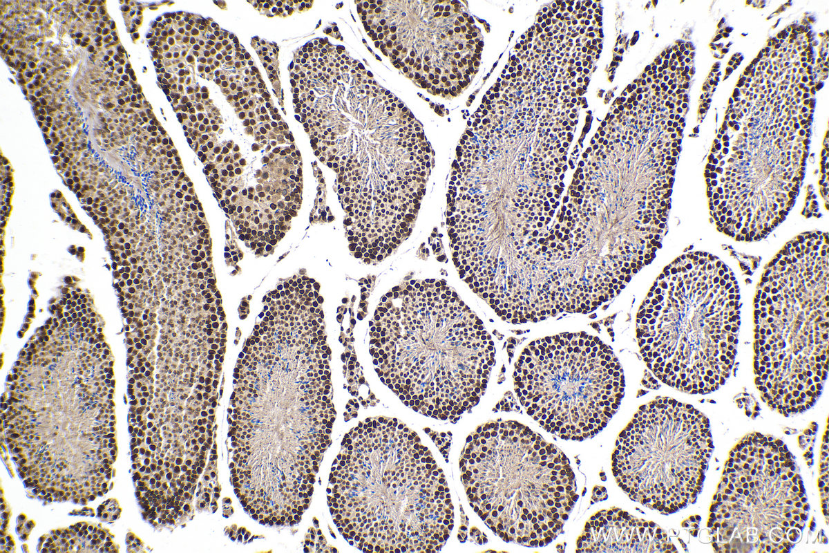 Immunohistochemical analysis of paraffin-embedded mouse testis tissue slide using KHC2104 (KIN IHC Kit).