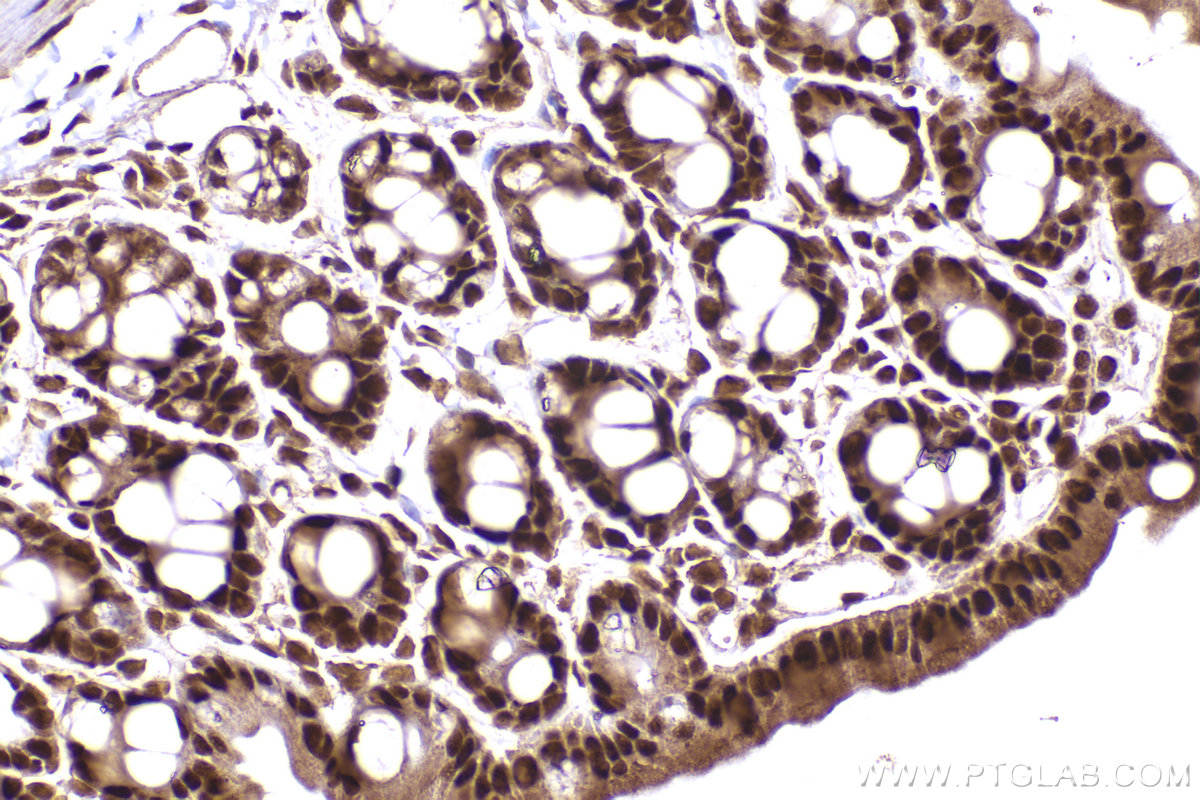 Immunohistochemical analysis of paraffin-embedded mouse intestine tissue slide using KHC2310 (KPNA1 IHC Kit).