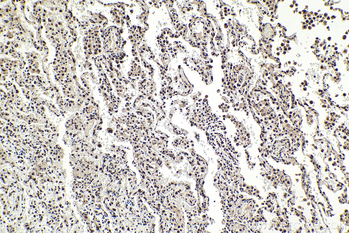 Immunohistochemical analysis of paraffin-embedded human lung tissue slide using KHC2102 (KPNA6 IHC Kit).