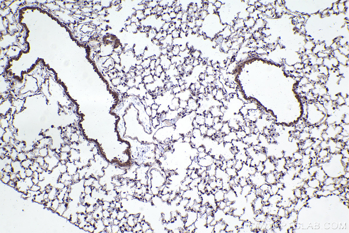 Immunohistochemical analysis of paraffin-embedded mouse lung tissue slide using KHC2467 (LBR IHC Kit).