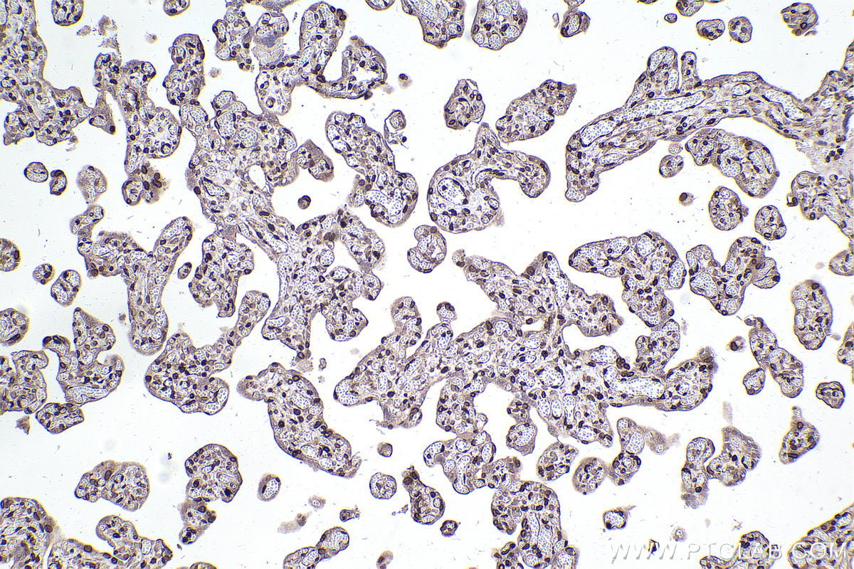 Immunohistochemical analysis of paraffin-embedded human placenta tissue slide using KHC2467 (LBR IHC Kit).