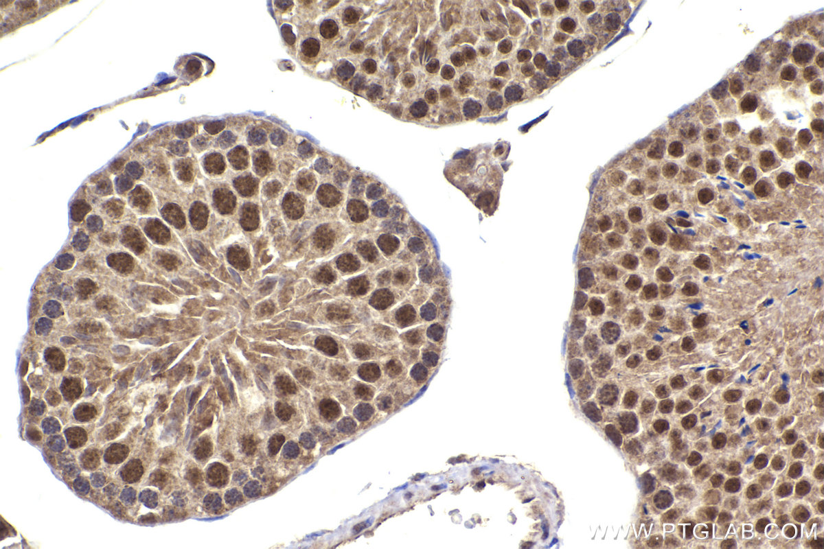 Immunohistochemical analysis of paraffin-embedded mouse testis tissue slide using KHC2294 (LIG3 IHC Kit).