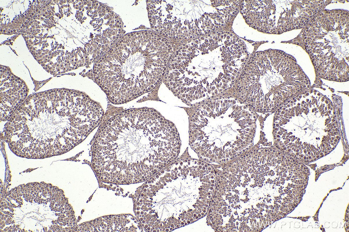 Immunohistochemical analysis of paraffin-embedded rat testis tissue slide using KHC2294 (LIG3 IHC Kit).