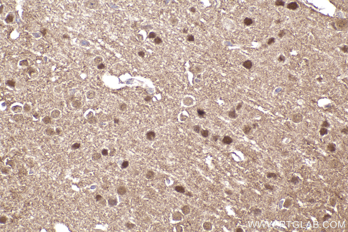 Immunohistochemical analysis of paraffin-embedded mouse brain tissue slide using KHC2317 (LIMK1 IHC Kit).