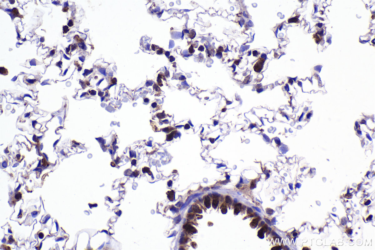 Immunohistochemical analysis of paraffin-embedded rat lung tissue slide using KHC2317 (LIMK1 IHC Kit).