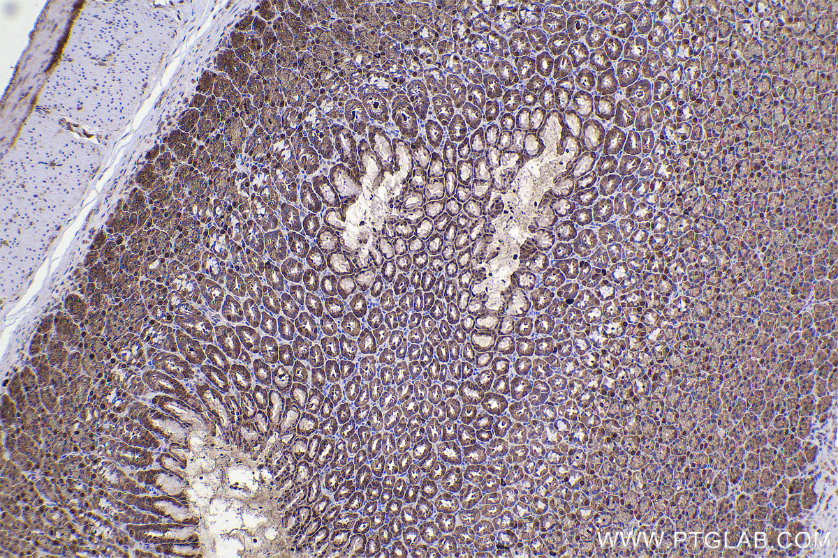 Immunohistochemical analysis of paraffin-embedded rat stomach tissue slide using KHC2317 (LIMK1 IHC Kit).