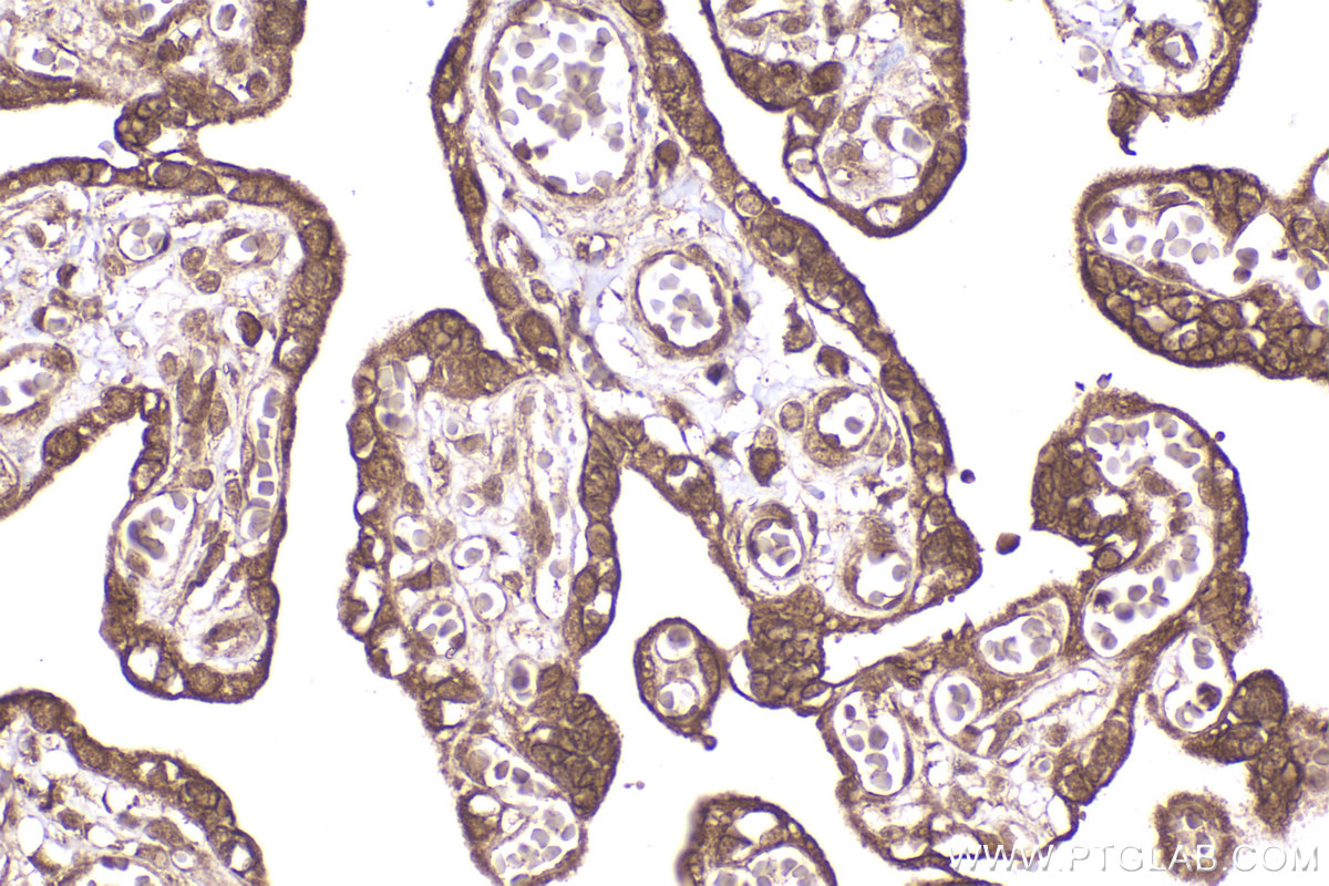 Immunohistochemical analysis of paraffin-embedded human placenta tissue slide using KHC2318 (LIMK2 IHC Kit).