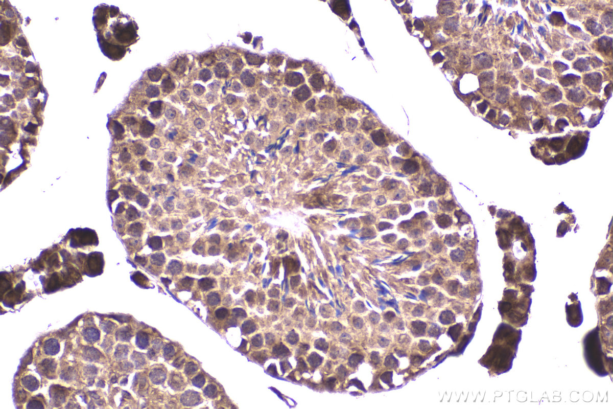 Immunohistochemical analysis of paraffin-embedded mouse testis tissue slide using KHC2318 (LIMK2 IHC Kit).