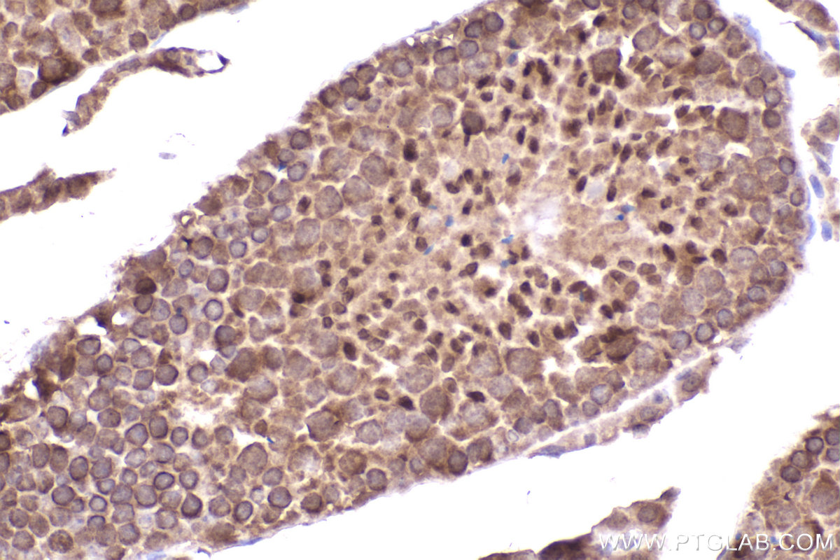 Immunohistochemical analysis of paraffin-embedded mouse testis tissue slide using KHC2272 (LIS1 IHC Kit).