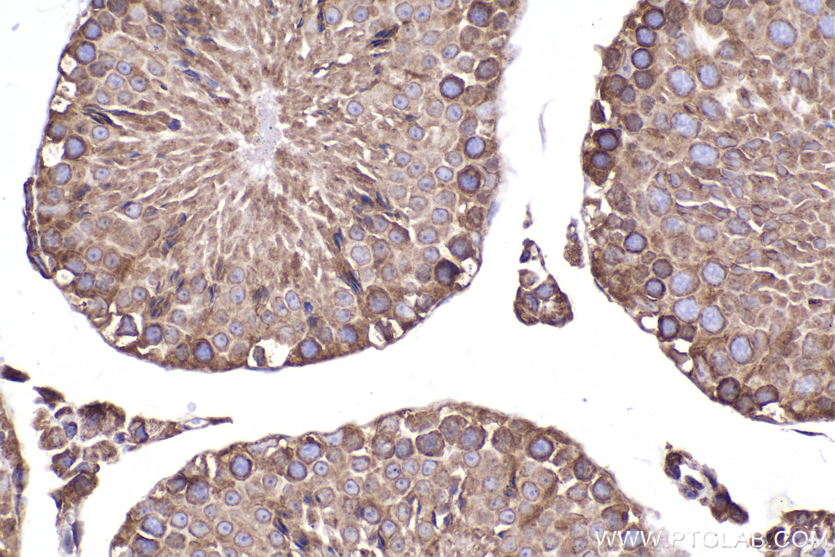 Immunohistochemical analysis of paraffin-embedded mouse testis tissue slide using KHC2287 (LMAN1 IHC Kit).