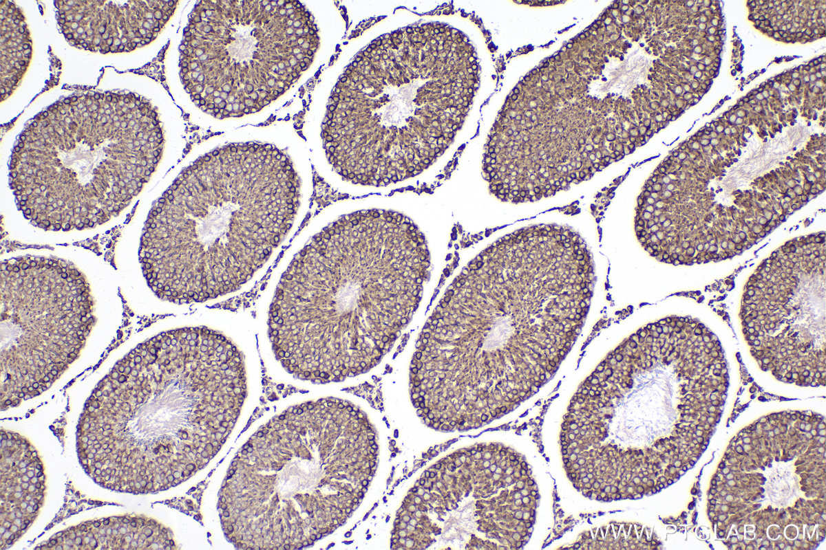 Immunohistochemical analysis of paraffin-embedded rat testis tissue slide using KHC2287 (LMAN1 IHC Kit).