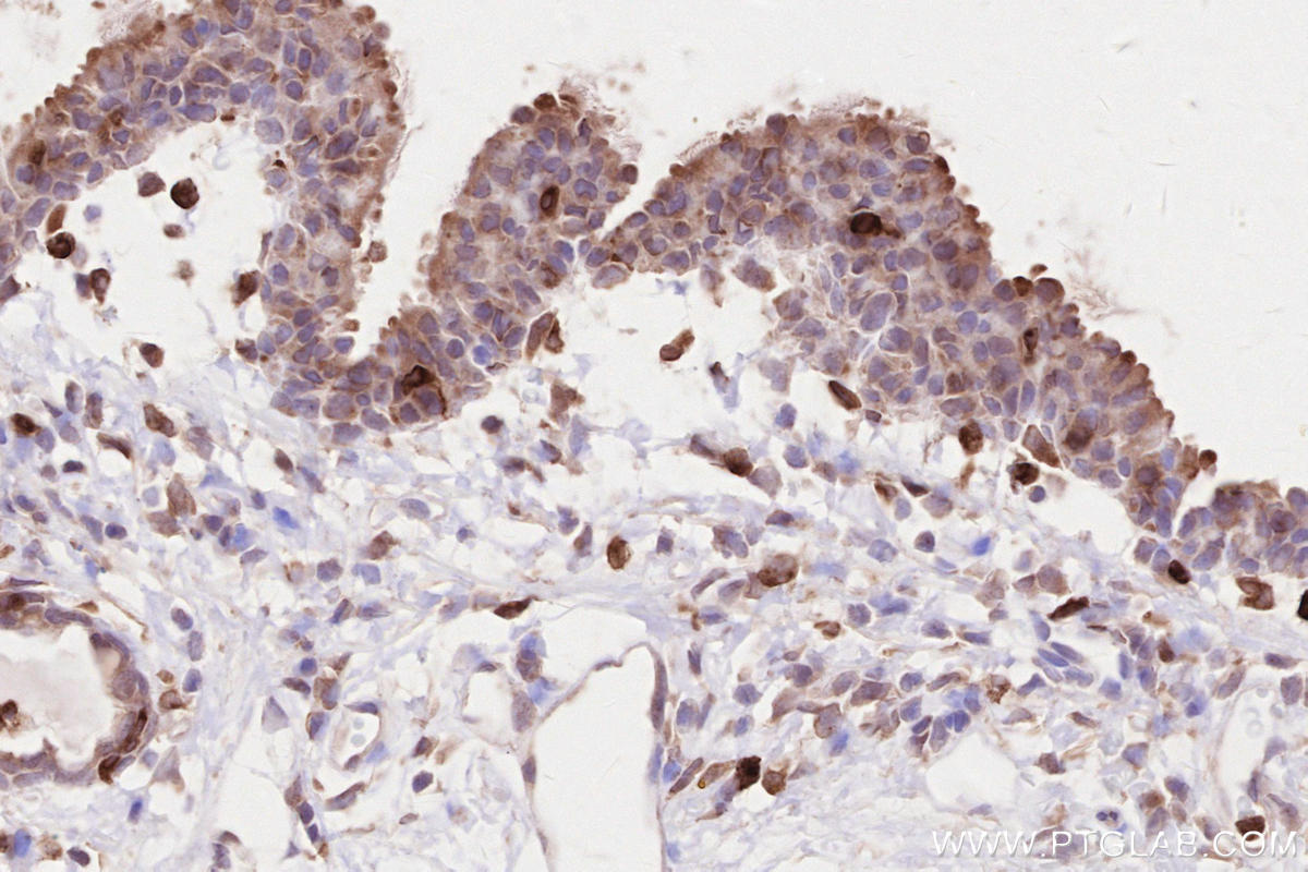 Immunohistochemical analysis of paraffin-embedded rat thyroid gland tissue slide using KHC2615 (LPCAT2 IHC Kit).