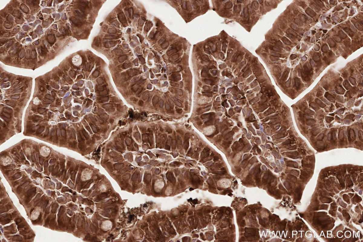 Immunohistochemical analysis of paraffin-embedded mouse small intestine tissue slide using KHC2570 (LPCAT4 IHC Kit).