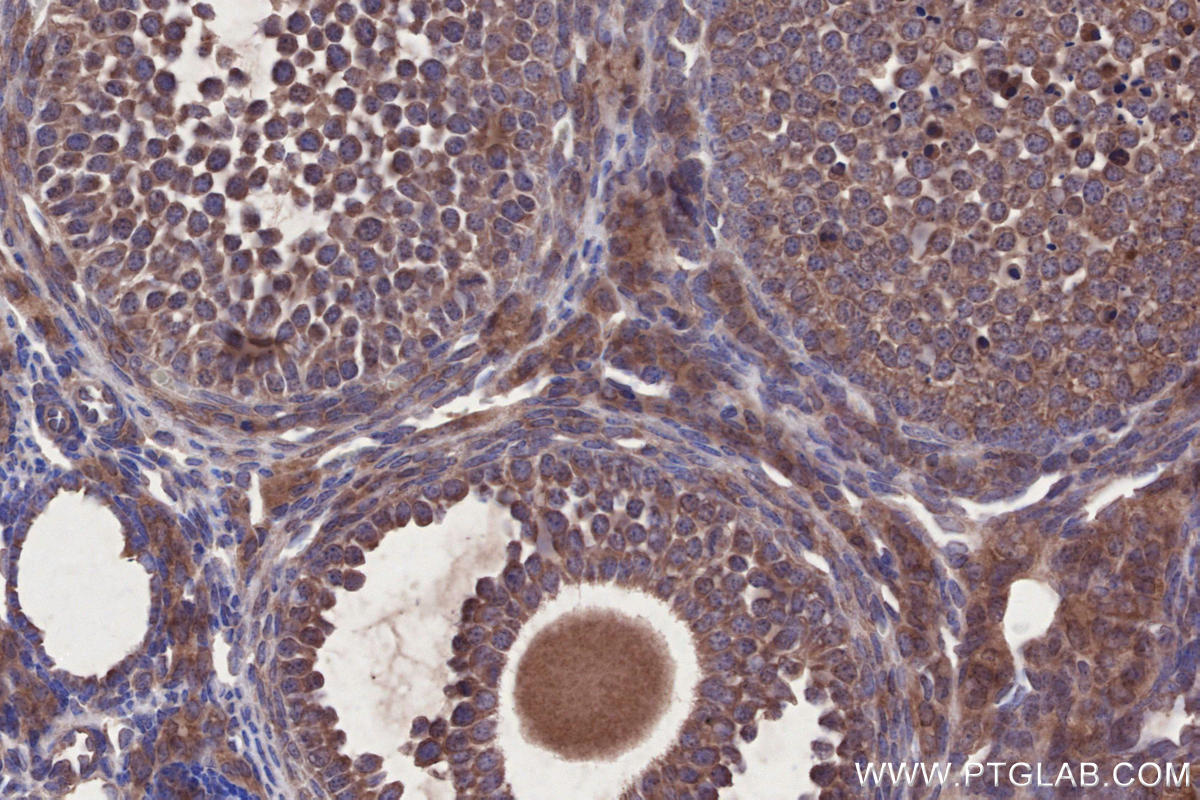 Immunohistochemical analysis of paraffin-embedded mouse ovary tissue slide using KHC2687 (LSM14A IHC Kit).