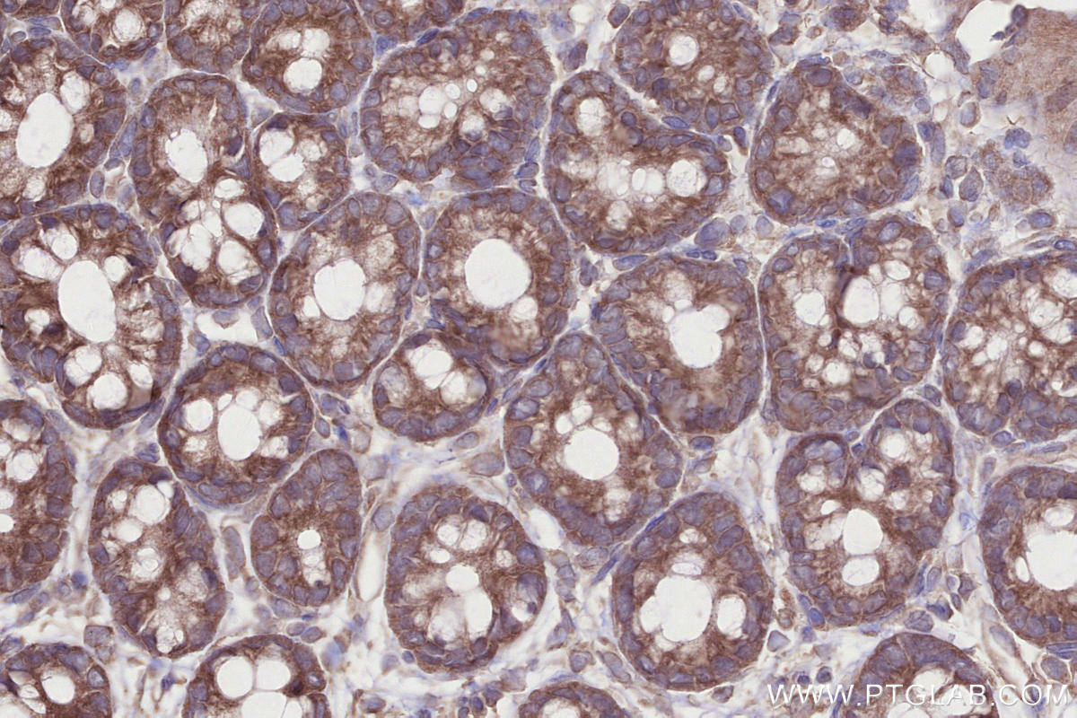 Immunohistochemical analysis of paraffin-embedded rat colon tissue slide using KHC2687 (LSM14A IHC Kit).