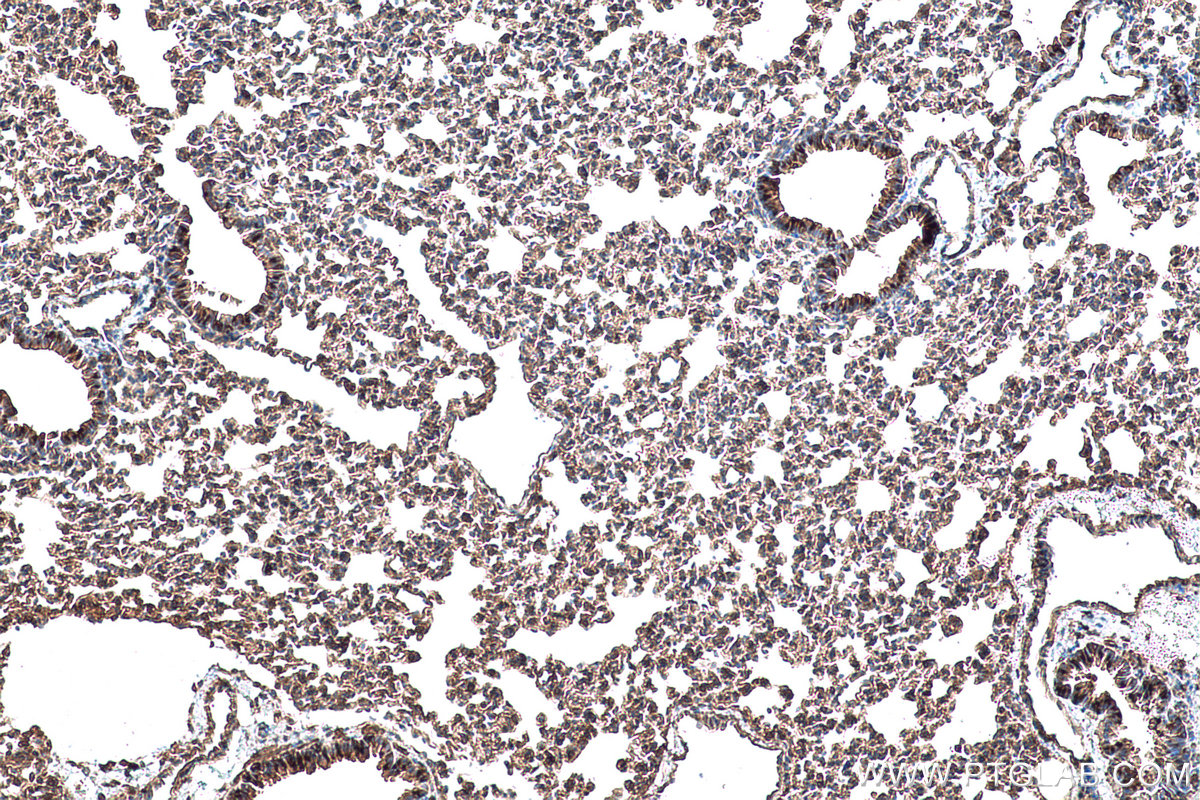 Immunohistochemical analysis of paraffin-embedded mouse lung tissue slide using KHC0956 (LZTFL1 IHC Kit).