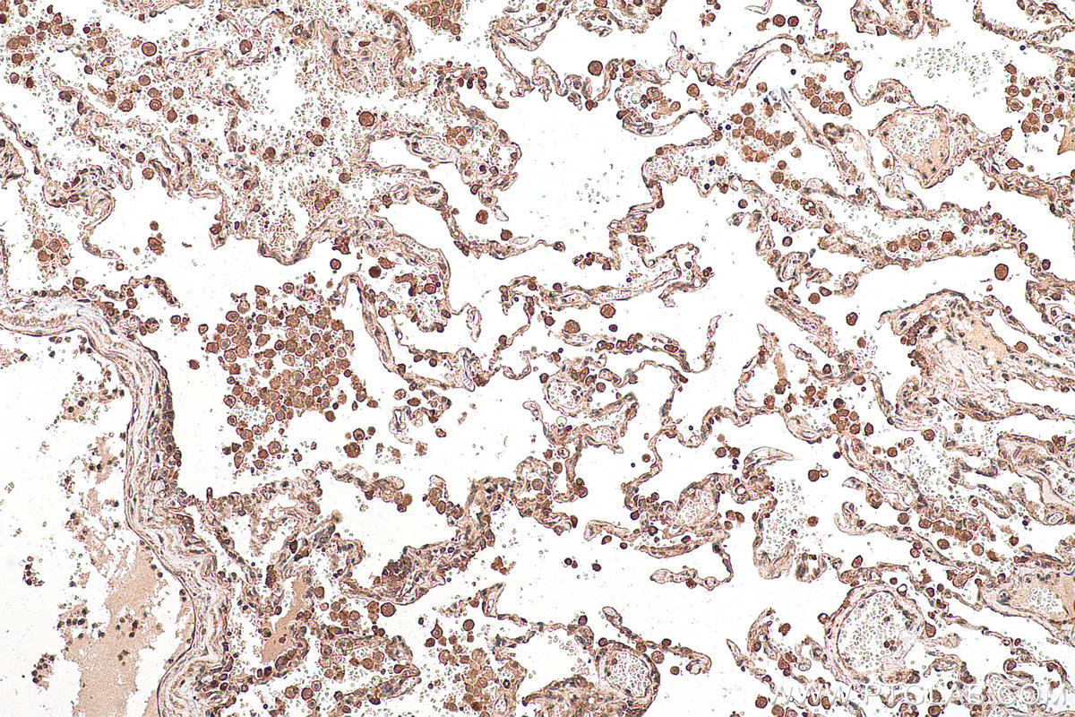 Immunohistochemical analysis of paraffin-embedded human lung tissue slide using KHC0956 (LZTFL1 IHC Kit).