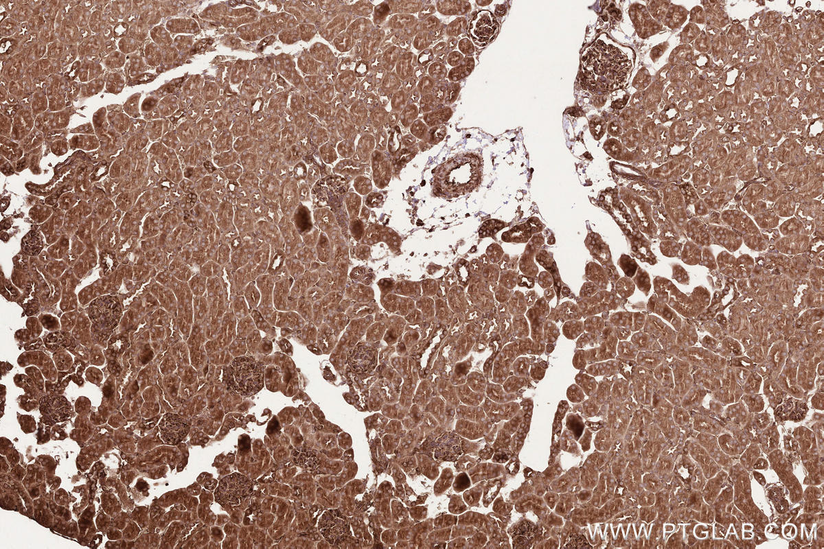 Immunohistochemical analysis of paraffin-embedded mouse kidney tissue slide using KHC2571 (MAP1S IHC Kit).