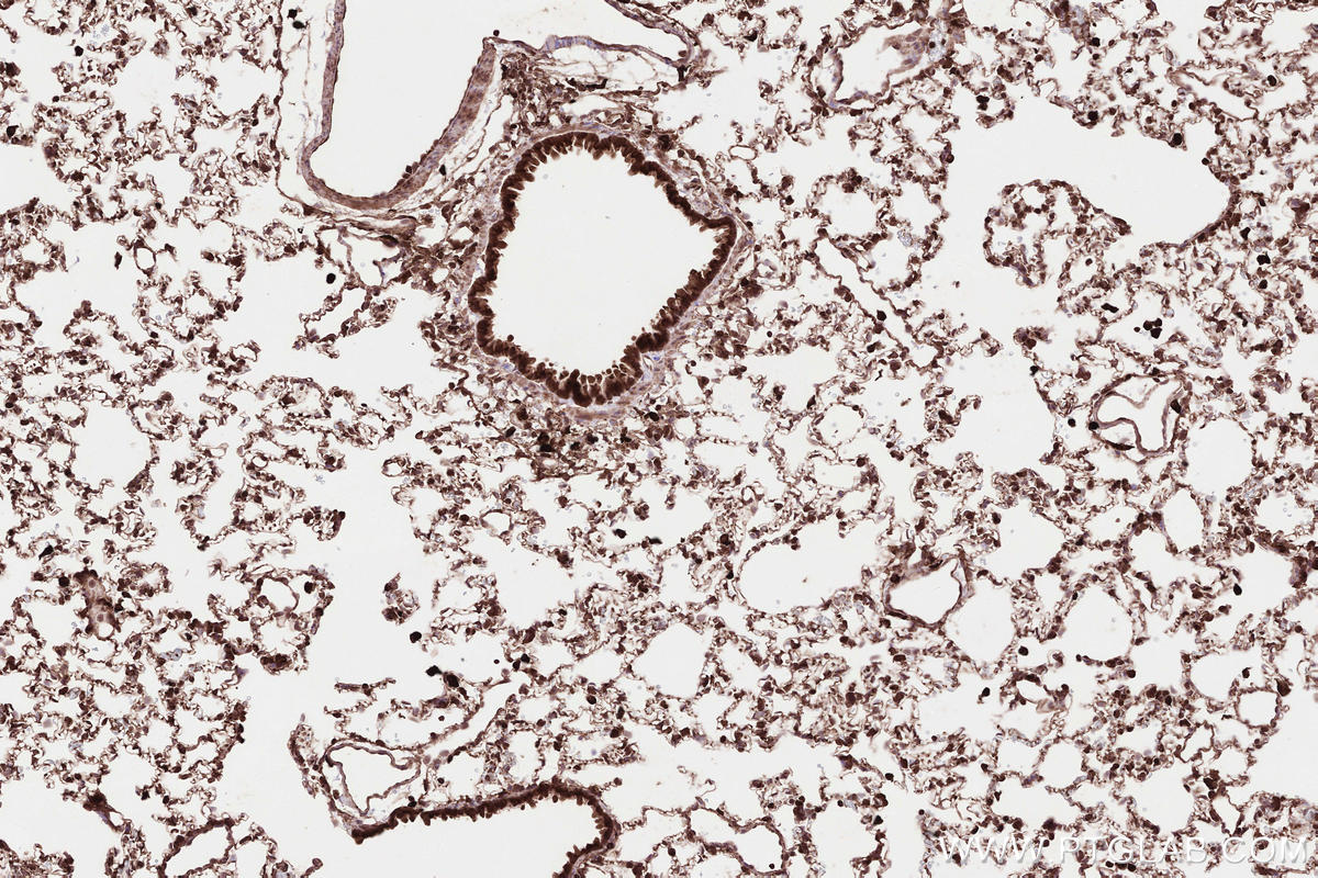 Immunohistochemical analysis of paraffin-embedded rat lung tissue slide using KHC2571 (MAP1S IHC Kit).