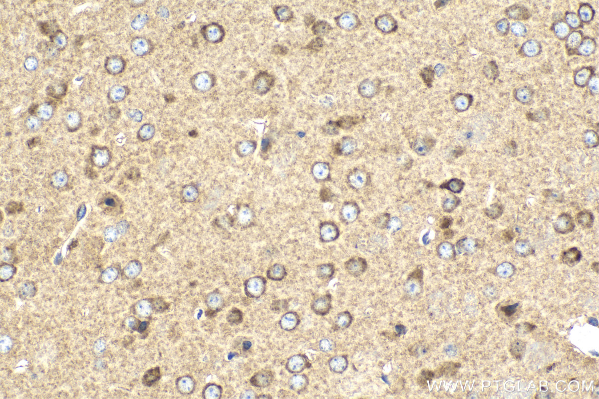 Immunohistochemical analysis of paraffin-embedded mouse brain tissue slide using KHC2149 (MAP4K4 IHC Kit).