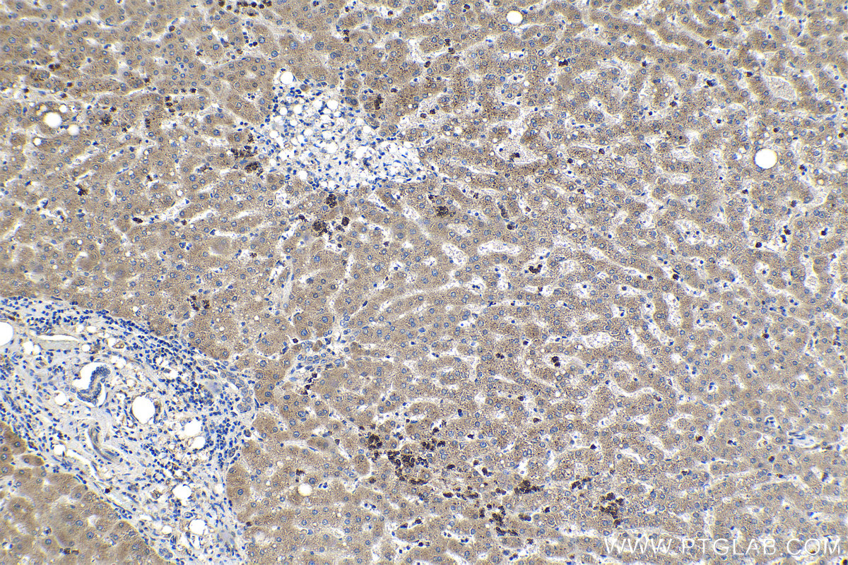 Immunohistochemical analysis of paraffin-embedded human liver tissue slide using KHC2149 (MAP4K4 IHC Kit).