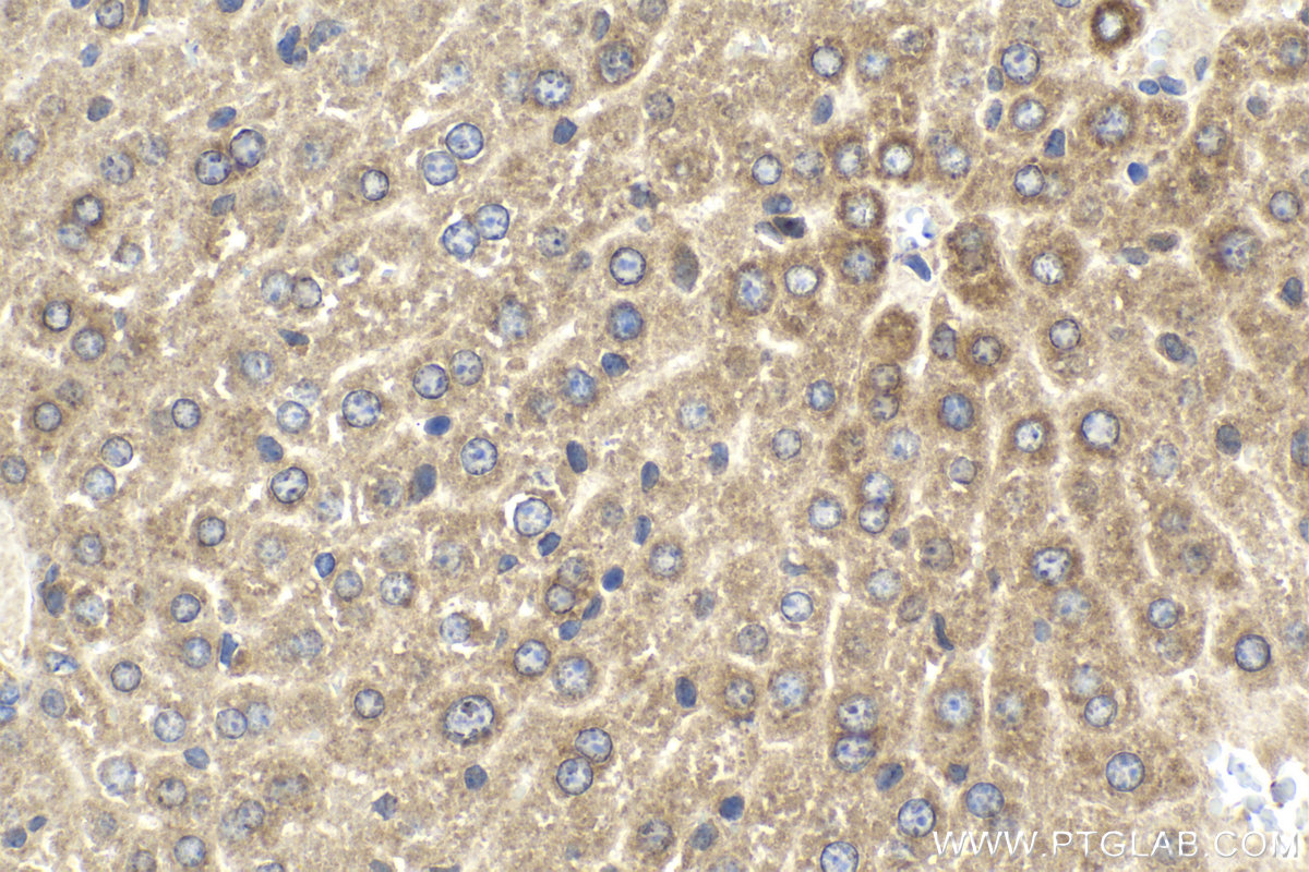 Immunohistochemical analysis of paraffin-embedded mouse liver tissue slide using KHC2149 (MAP4K4 IHC Kit).