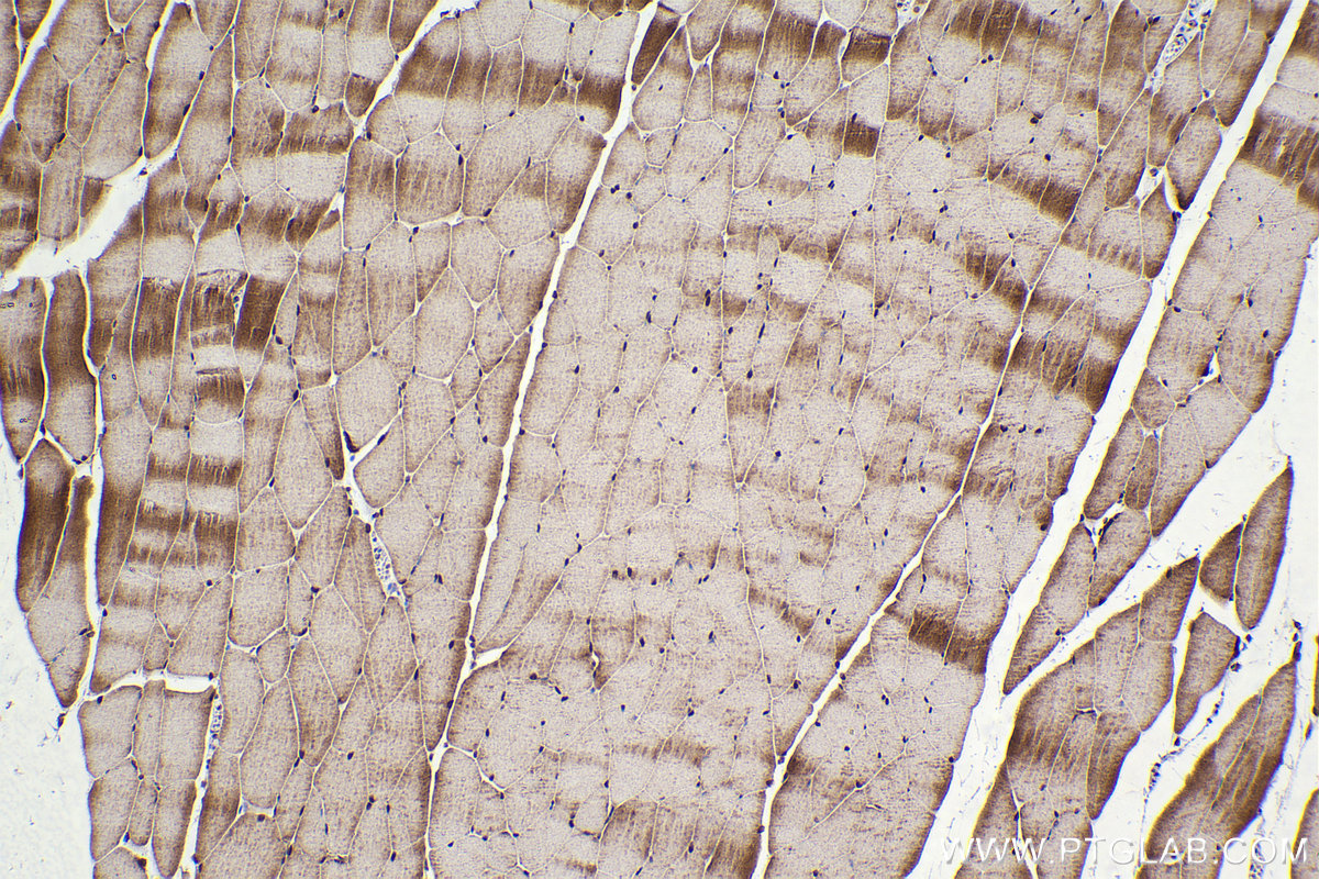 Immunohistochemical analysis of paraffin-embedded mouse skeletal muscle tissue slide using KHC2320 (MAPK12 IHC Kit).