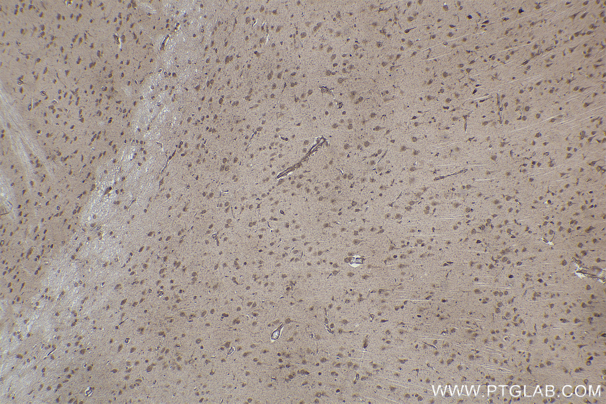 Immunohistochemical analysis of paraffin-embedded rat brain tissue slide using KHC2232 (MAPK4 IHC Kit).