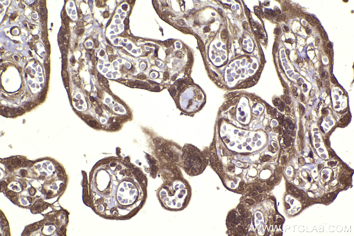 Immunohistochemical analysis of paraffin-embedded human placenta tissue slide using KHC2267 (MAPK8/JNK IHC Kit).