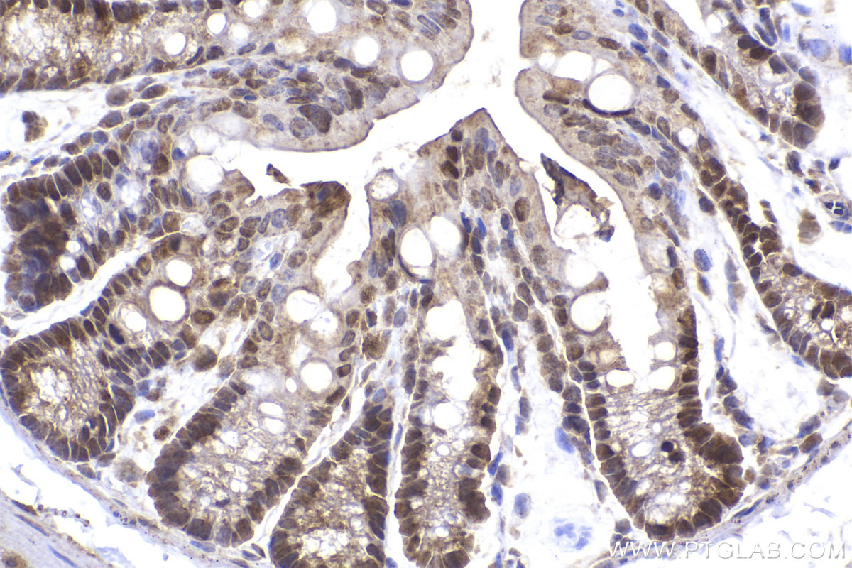 Immunohistochemical analysis of paraffin-embedded mouse colon tissue slide using KHC2267 (MAPK8/JNK IHC Kit).