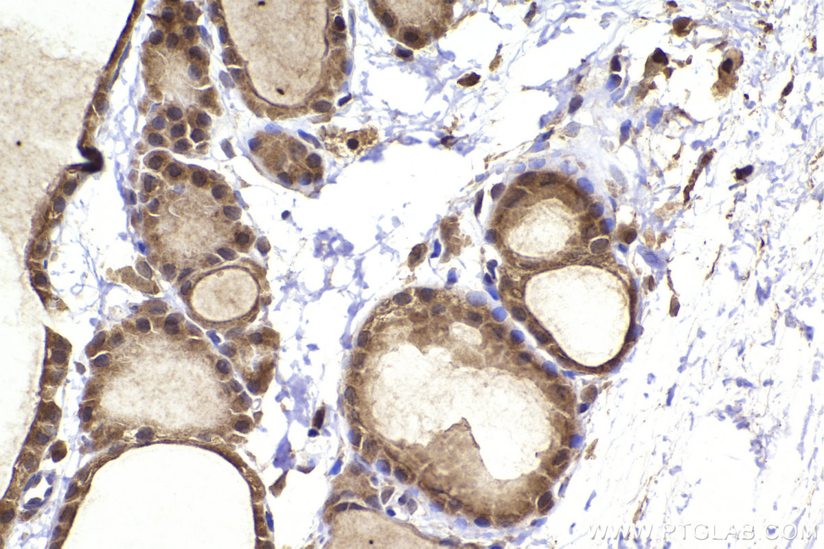 Immunohistochemical analysis of paraffin-embedded rat thyroid gland tissue slide using KHC2347 (MAPKAPK2 IHC Kit).