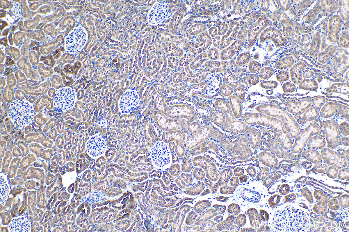 Immunohistochemical analysis of paraffin-embedded rat kidney tissue slide using KHC1287 (MAPKBP1 IHC Kit).