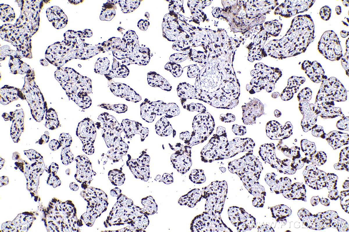 Immunohistochemical analysis of paraffin-embedded human placenta tissue slide using KHC2263 (MATR3 IHC Kit).