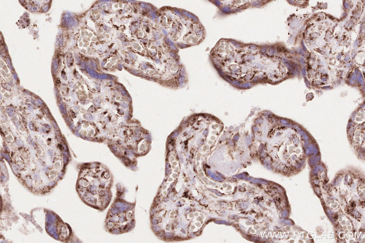 Immunohistochemical analysis of paraffin-embedded human placenta tissue slide using KHC2620 (MAVS IHC Kit).