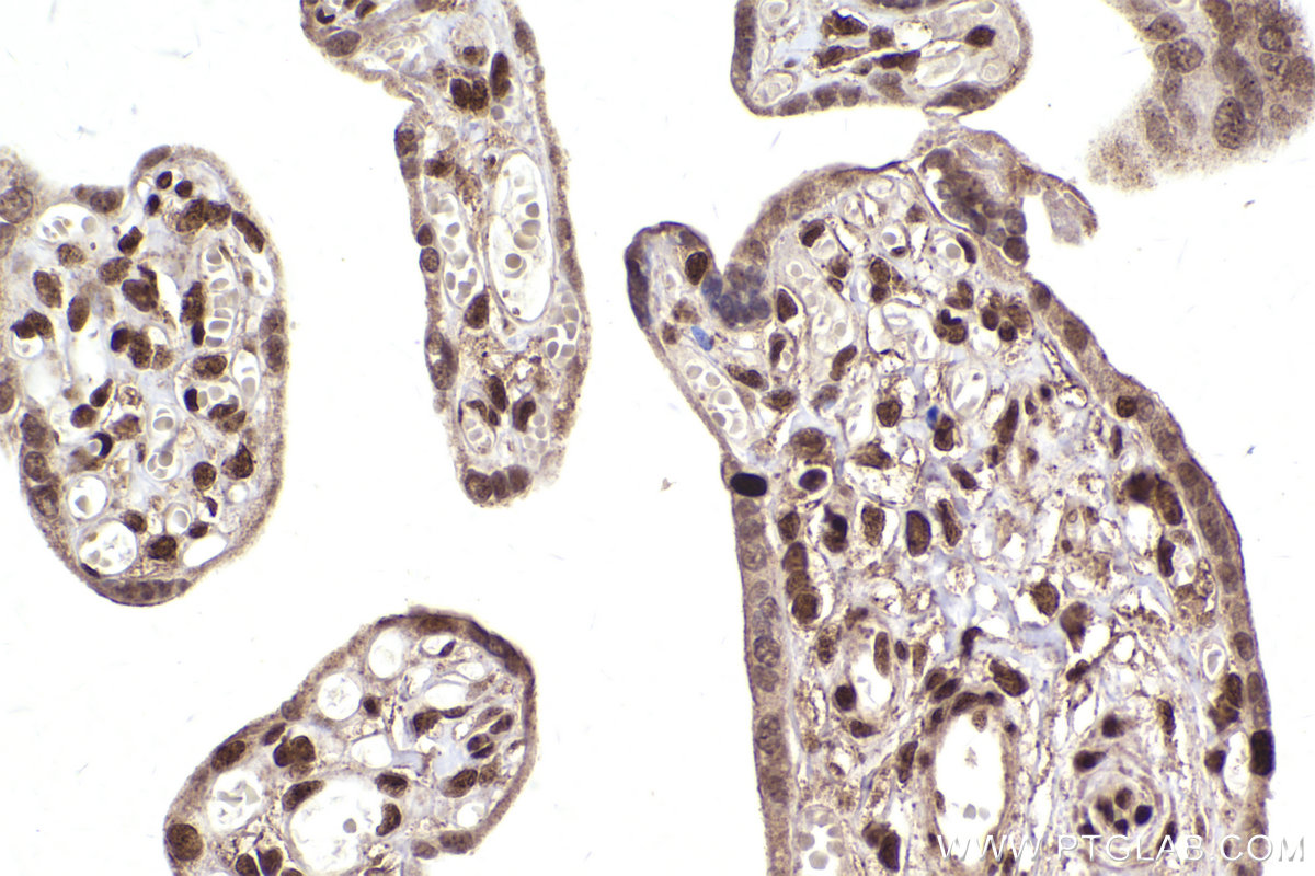 Immunohistochemical analysis of paraffin-embedded human placenta tissue slide using KHC2462 (MDC1 IHC Kit).