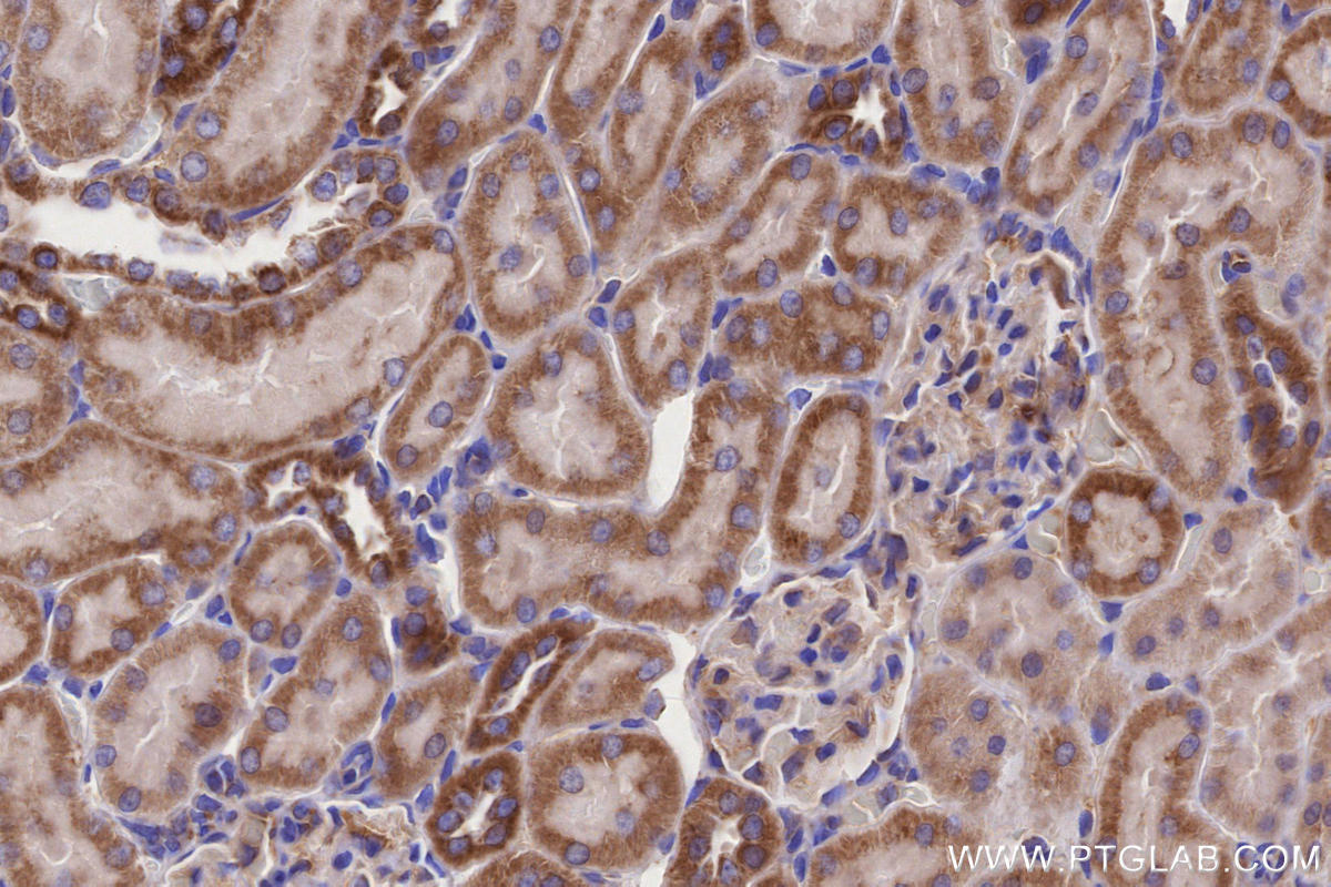 Immunohistochemical analysis of paraffin-embedded rat kidney tissue slide using KHC2650 (MFN1 IHC Kit).