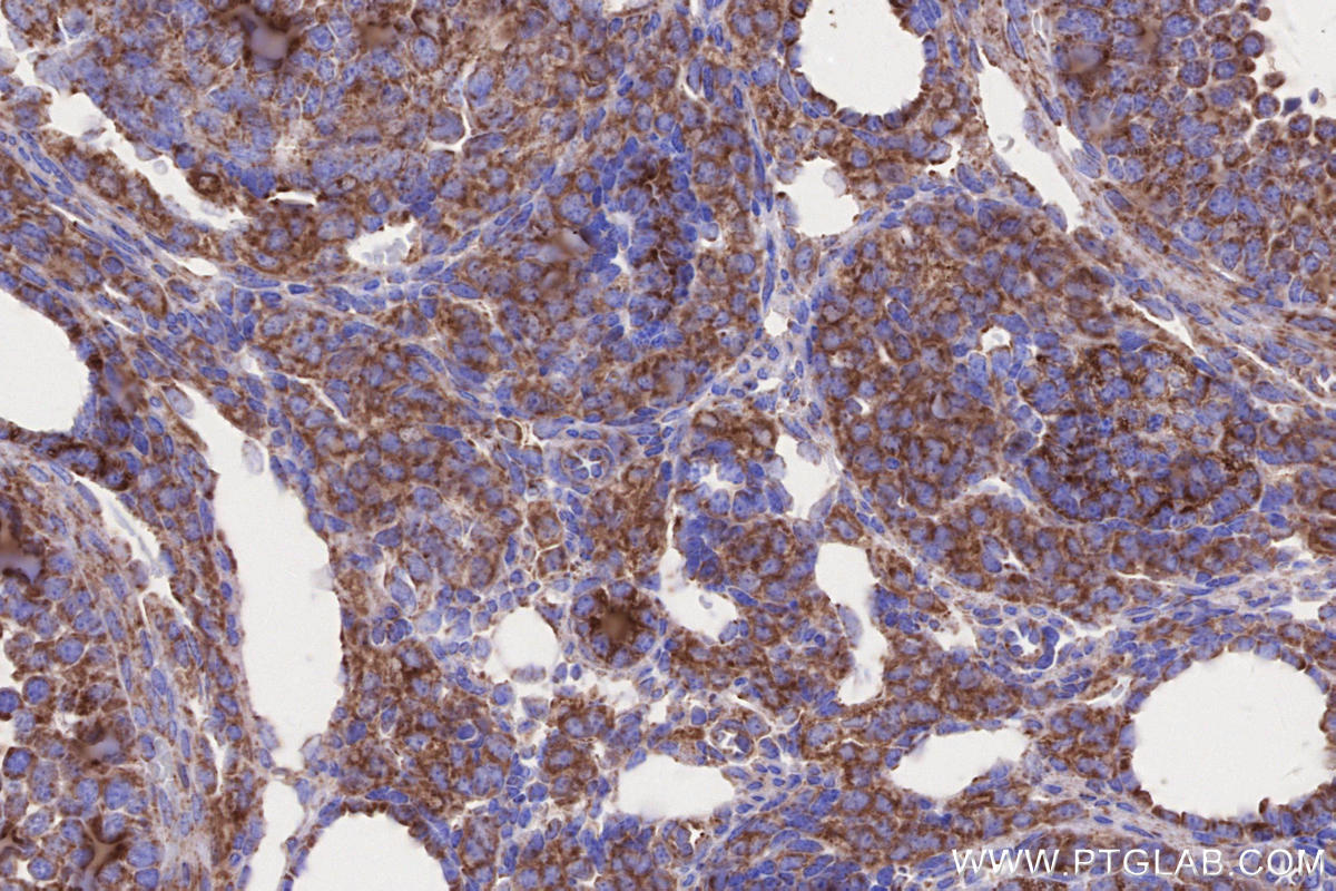 Immunohistochemical analysis of paraffin-embedded mouse ovary tissue slide using KHC2650 (MFN1 IHC Kit).