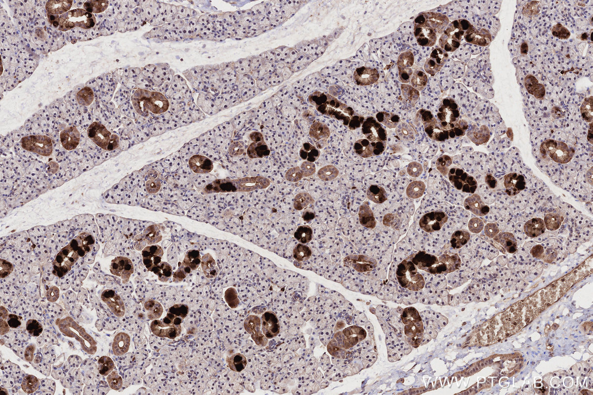 Immunohistochemical analysis of paraffin-embedded rat salivary gland tissue slide using KHC2686 (MLKL IHC Kit).