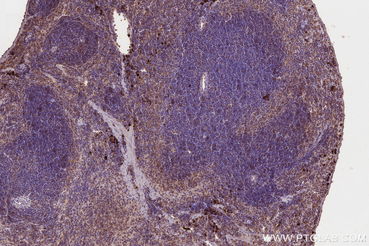 Immunohistochemical analysis of paraffin-embedded mouse spleen tissue slide using KHC2686 (MLKL IHC Kit).