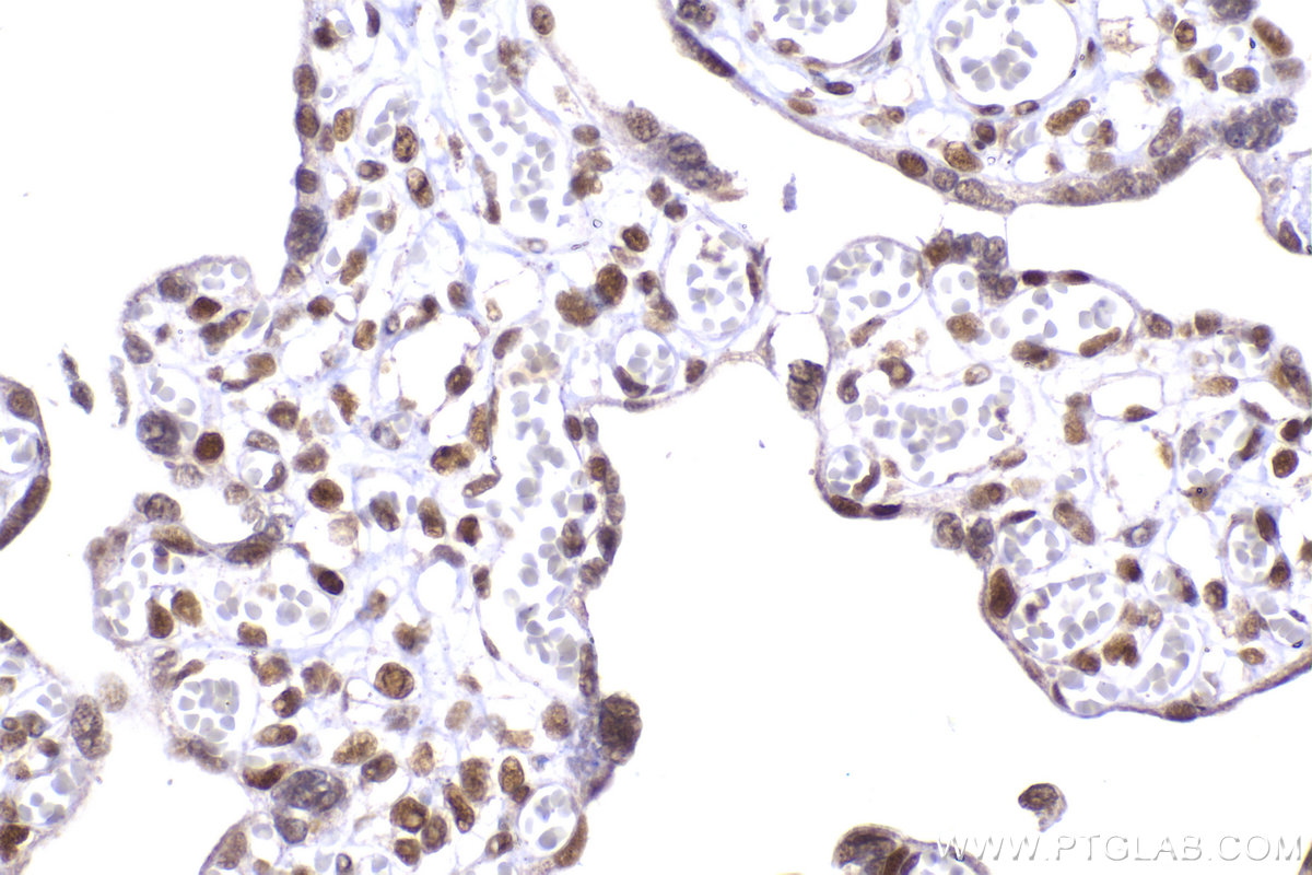 Immunohistochemical analysis of paraffin-embedded human placenta tissue slide using KHC2270 (MSH2 IHC Kit).