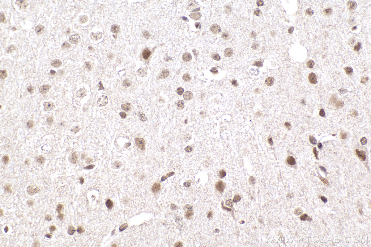 Immunohistochemical analysis of paraffin-embedded mouse brain tissue slide using KHC2270 (MSH2 IHC Kit).